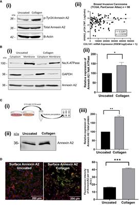 Collagen-I influences the post-translational regulation, binding partners and role of <mark class="highlighted">Annexin A2</mark> in breast cancer progression